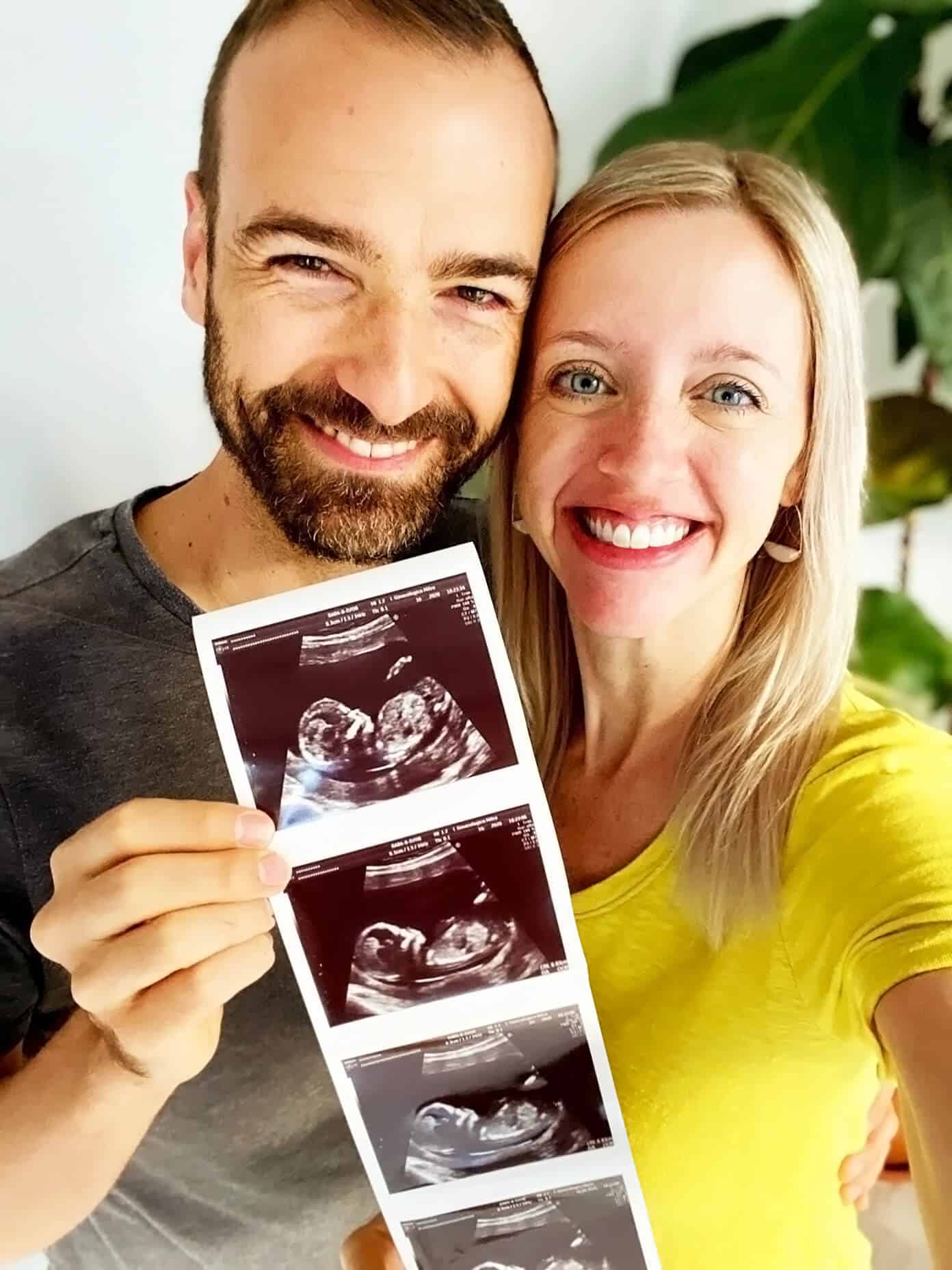 Our Barcelona Bebé | Gimme Some Oven #pregnancy #infertilityjourney #ivf #spain Ali and Barclay Holding Sonogram Photos